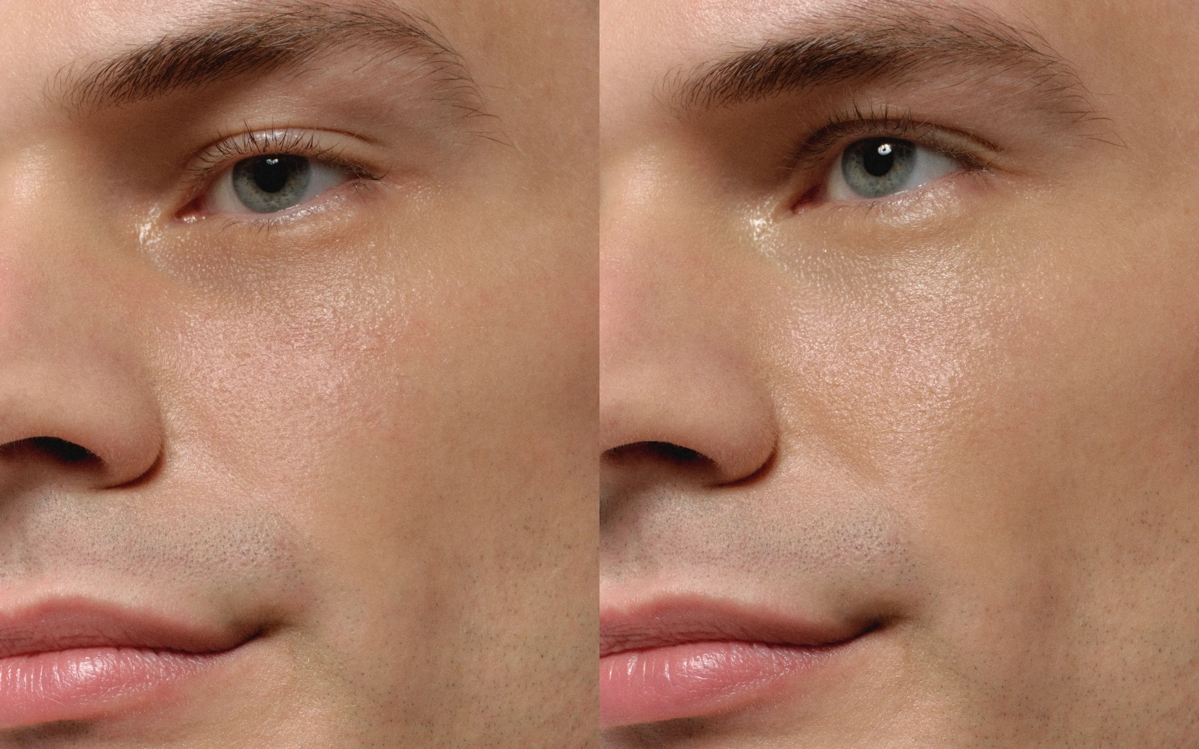 Before and after eye-area comparison showing tired-looking under-eyes looking more awake